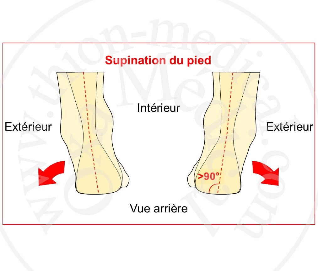 Schéma de la supination du pied